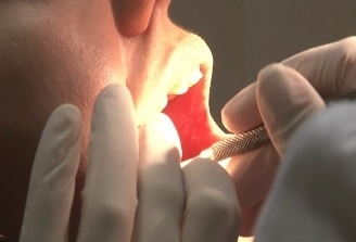 Durerile de dinti: care sunt cele mai frecvente cauze si cum pot fi prevenite