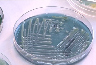 Soluție pentru tratarea superbacteriilor: Medicamentele pe bază de aur