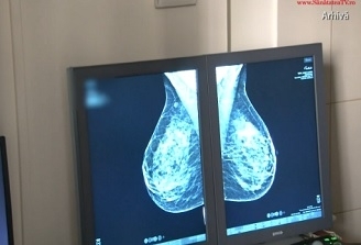 Spitalul Judetean de Urgenta Cluj are un mamograf nou. Peste 4000 de paciente vor beneficia anual de serviciile de imagistica