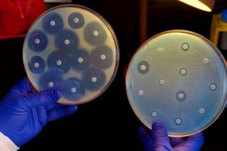 Antibioticele nu mai fac fata. Lista superbacteriilor considerate pericole urgente, tot mai mare in Statele Unite