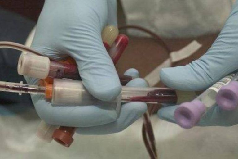 Testari gratuite pentru HIVsi Hepatite in cinci centre din Bucuresti. Perioadasi locatiile in care se pot face testarile