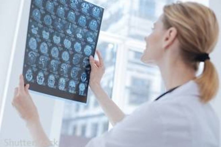 Care este legatura dintre calitatea somnuluisi bolile cardiacesi accidentele vasculare cerebrale