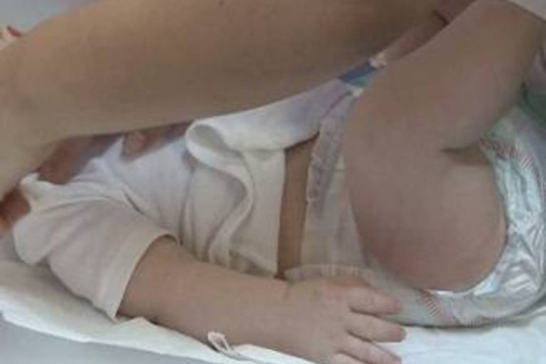 Pintea: Inca doi copii diagnosticati cu stafilococ auriu, internati la Spitalul „Grigore Alexandrescu”
