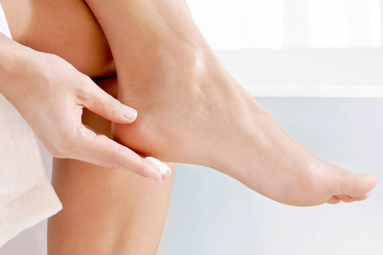 Probleme dermatologice in diabetul zaharat