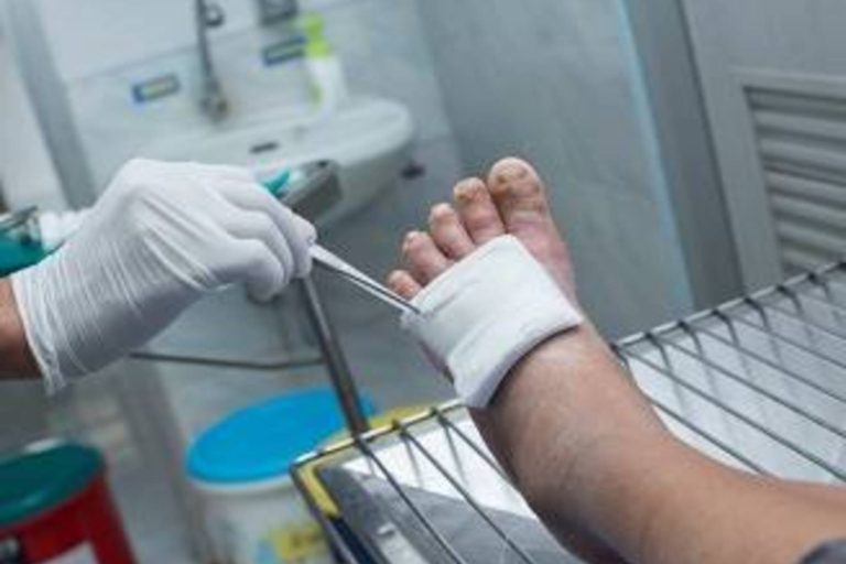 Neuropatia diabetica, o provocare pentru medicii de familie