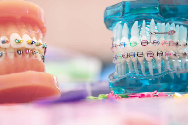ASSMB face modificari in regulamentul Proiectului „Smile”
