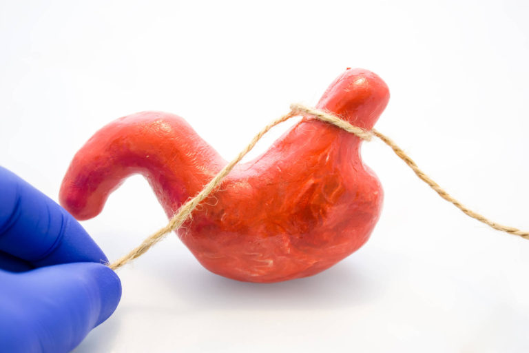 Operatia pentru slabit, benefica in cazul adolescentilor obezi – studiu