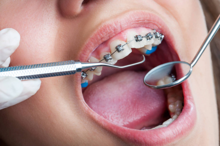 In judetul Iasi sunt 1.500 de medici dentişti şi doar 30 asistenţi medicali stomatologi – decanul Facultatii de Medicina Dentara din Iasi