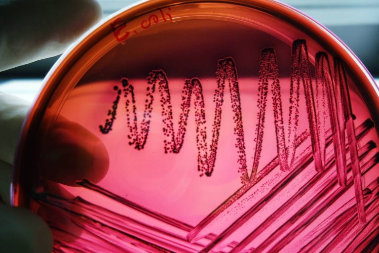 Apa de la Spitalul Judetean de Urgenta Vaslui, infestata cu bacteria E.coli