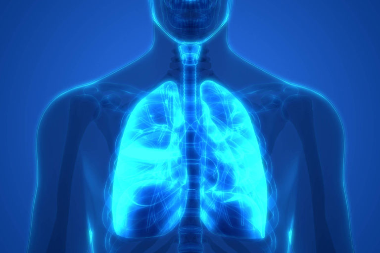 O noua speranta pentru pacientii cu cancer pulmonar