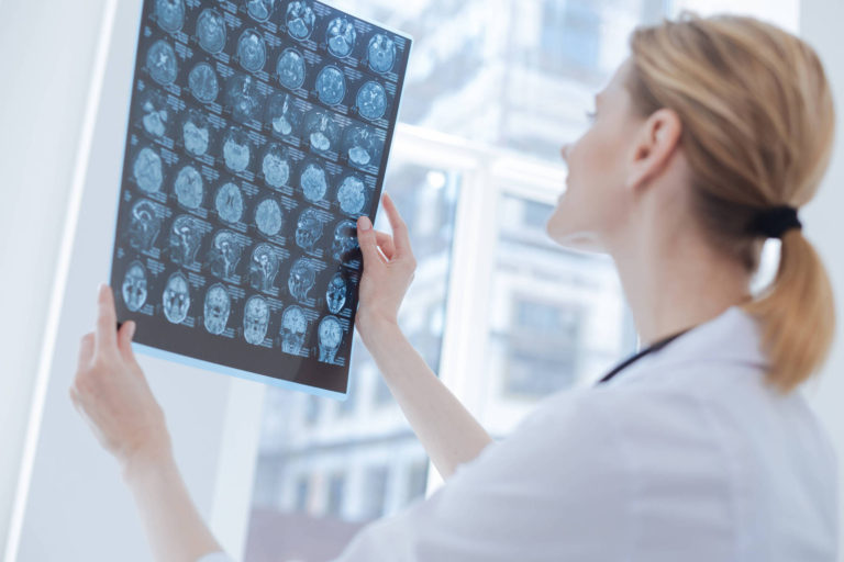 Interviu dr. Ioana Mandruta: Personalizarea tratamentelorsi a modalitatilor de diagnosticare in epilepsie este drumul catre succes