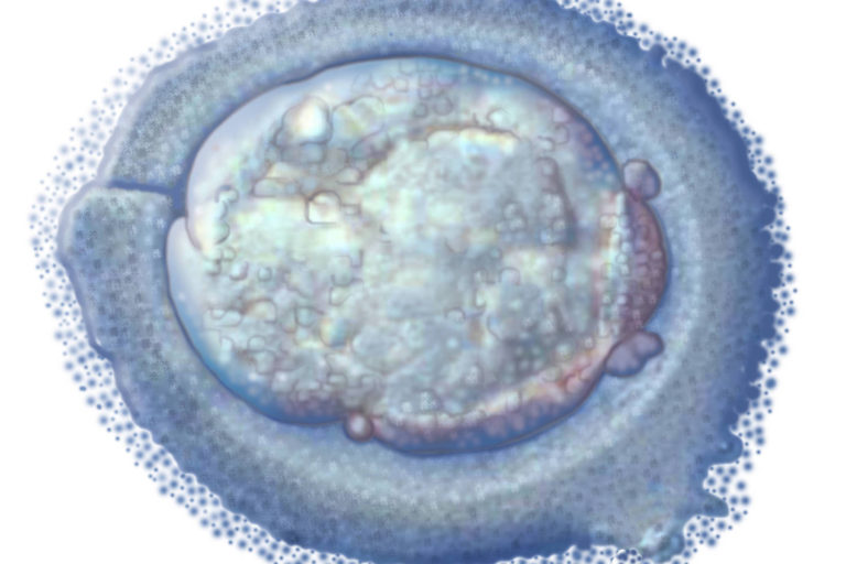 Adrian Streinu-Cercel: Un nou virus hepatic se raspandeste in Romania