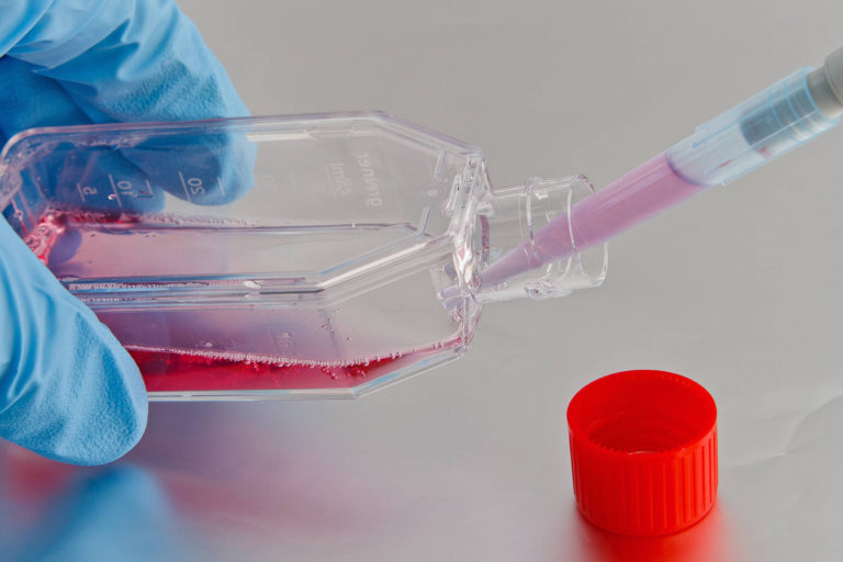 Studiu: Prea putine bacterii vaginale bune pot creste riscul de dezvoltare a cancerului ovarian