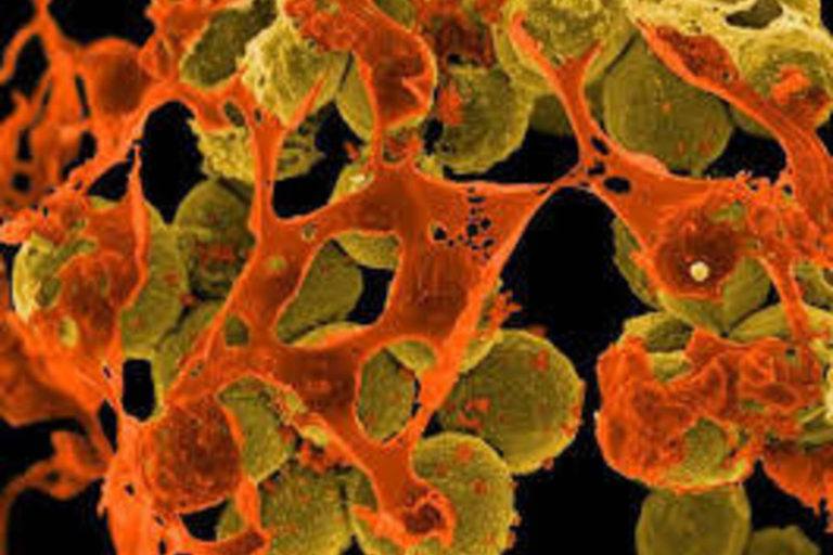 Doi copii nascuti la Maternitatea Giulesti, infectati cu stafilococul auriu