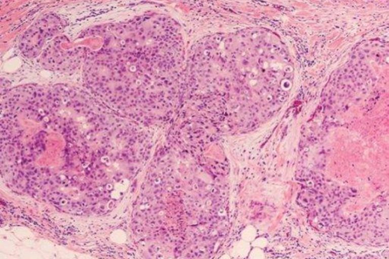 OncoHelp obține reacreditare ESMO pentru standarde europene în tratamentul oncologic și paliativ