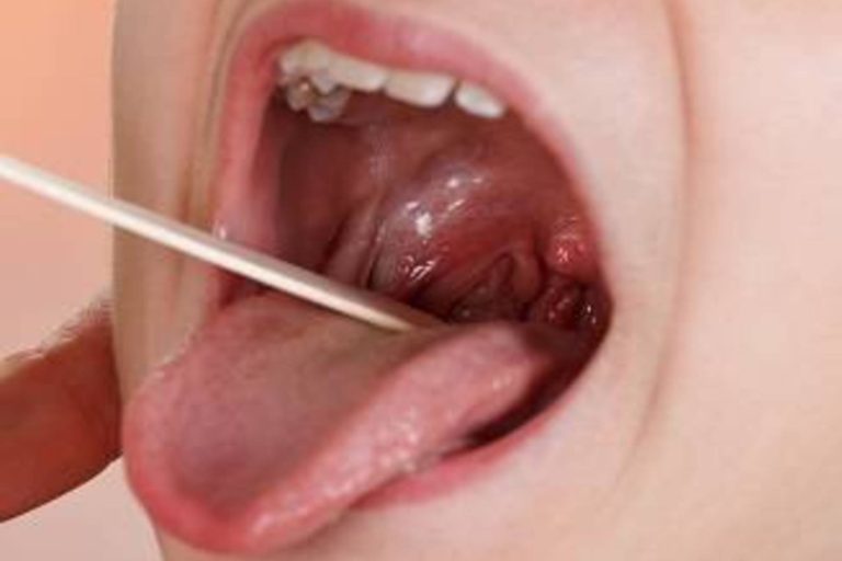 Caderi, gastroenterite sau bronsiolite „ principalele motive pentru care parintii isi duc copiii la urgente
