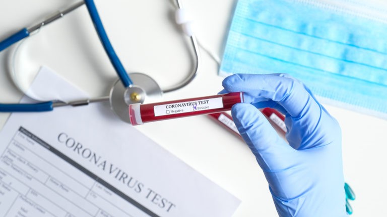 186 de cazuri noi de îmbolnăvire cu SARS-COV-2 în România