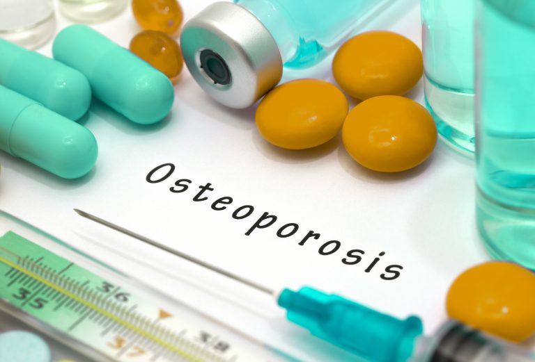 Osteoporoza crește riscul fracturilor la adulții peste 50 de ani, avertizează Spitalul Clinic CF Timișoara