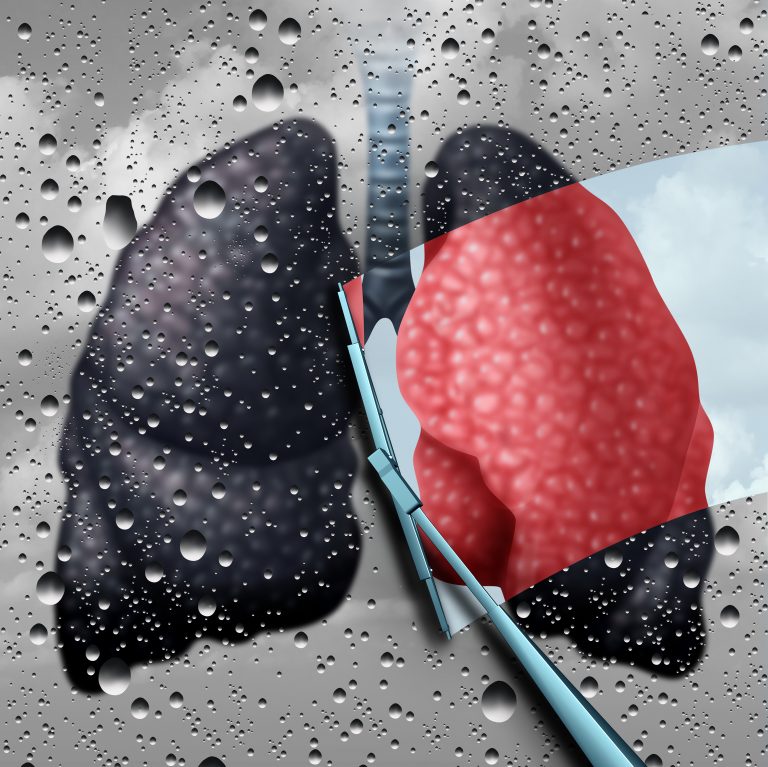 Cancerul pulmonar din România, agravat de diagnosticarea tardivă și absența politicilor publice, avertizează FABC