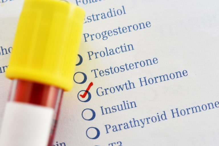 Acromegalia, o afecțiune endocrină rară