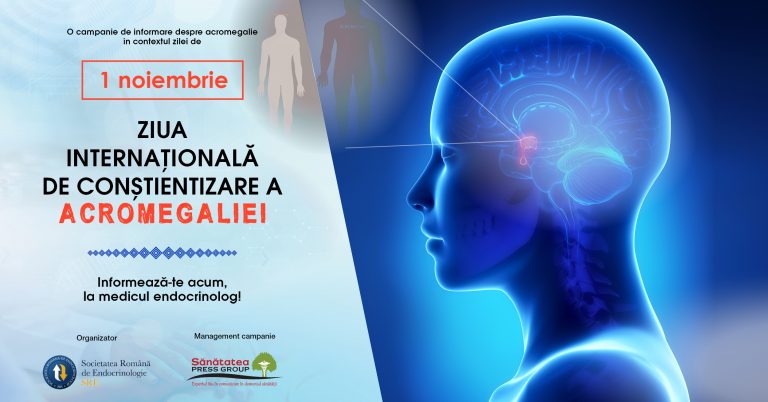 Astăzi se marchează Ziua Internațională de Conștientizare a Acromegaliei
