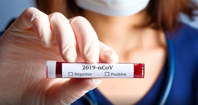 Ministerul Sănătăţii: Gradul de pozitivare pentru testele COVID-19 este de 23,92%