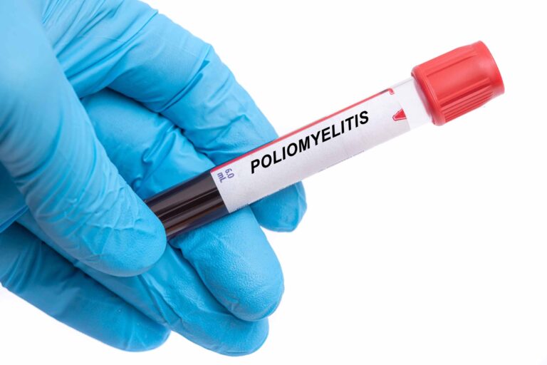 SUA înregistrează primul caz de poliomielită după aproape un deceniu