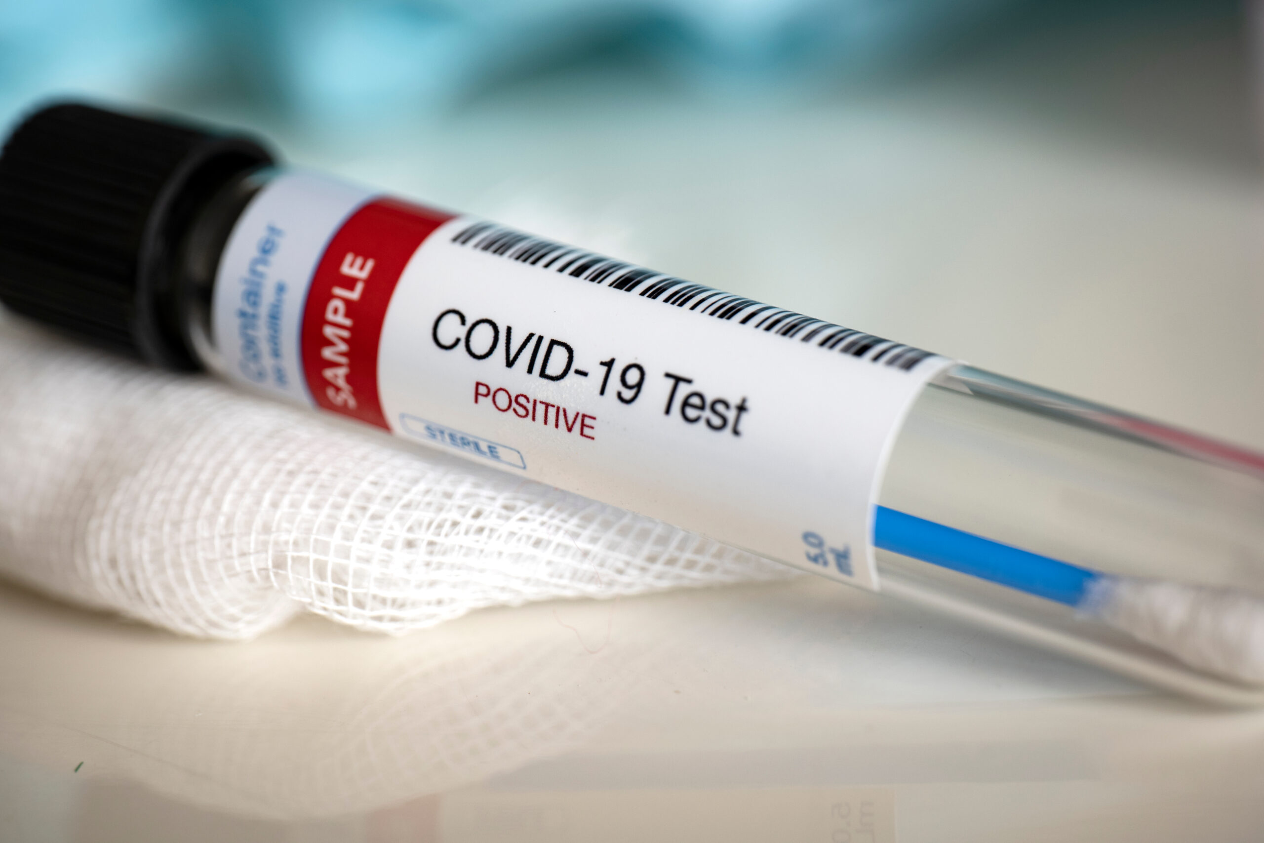 Bilanț COVID-19: Sub 2.700 de noi infectări, în ultimele 24 de ore. La ATI sunt internați 279 de pacienți
