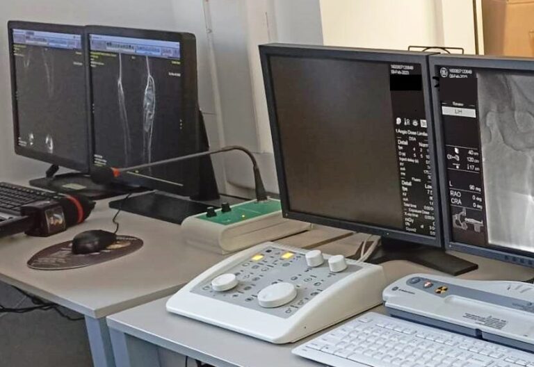SCJU Cluj-Napoca: Embolizarea unei malformaţii arteriovenoase cu materiale speciale pe bază de polimeri, în premieră națională