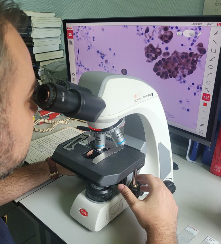 Sindromul Lynch, una dintre cele mai frecvente forme genetice de cancer
