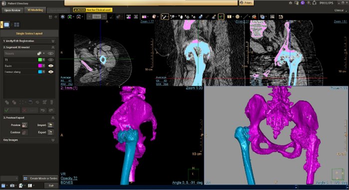 Unul dintre cele mai avansate instrumente de vizualizare și planificare din domeniul medical, în exploatarea Laboratorului de Printare 3D din cadrul CieH-UMFCD I