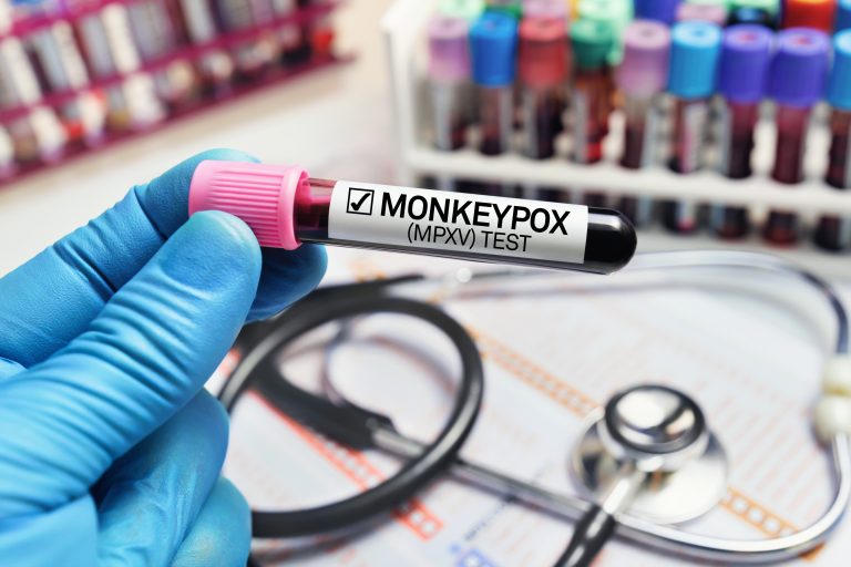 India a confirmat un caz de mpox