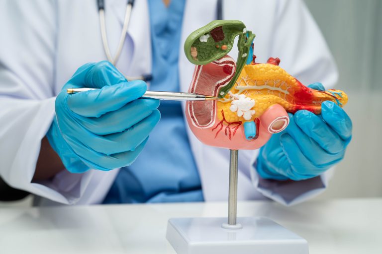 Proiect internațional dedicat cercetării în cancerele pancreatico-biliare, desfășurat de UMF „Carol Davila”